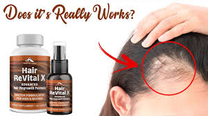 Hair Revital X – pour la perte de cheveux - dangereux – effets secondaires – site officiel
